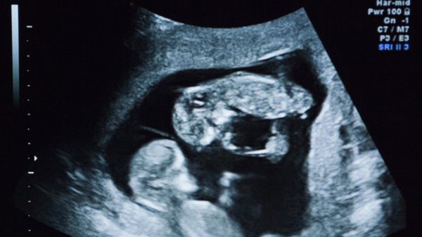 The Legality of Surrogacy and Its&nbsp;Implications